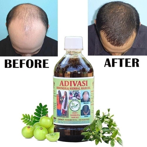 Dht blocker hair - dht,